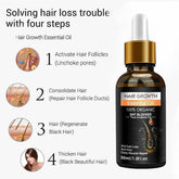 Peimei Hair growth Oil biotin cold pressed DHT blocker 30ml - YehChez.pk
